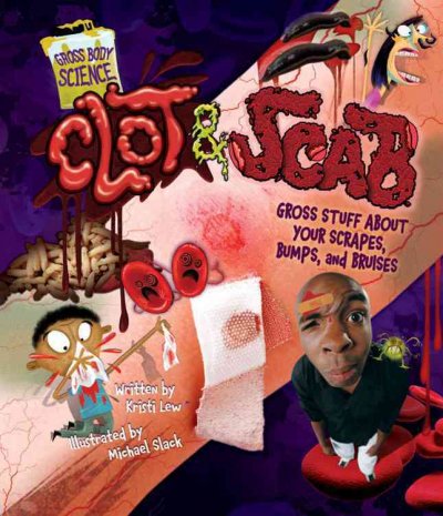 Clot & scab : gross stuff about your scrapes, bumps, and bruises / written by Kristi Lew ; illustrated by Michael Slack.