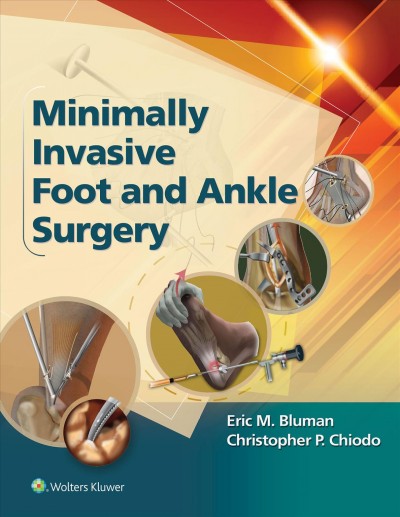 Minimally invasive foot and ankle surgery / editors, Eric M. Bluman, MD, Phd, Medical Director, Division of Foot and Ankle, Brigham and Women's Hospital, Harvard Medical School, Boston, Massachusetts, Christopher P. Chiodo, MD, Chief, Foot and Ankle Surgery Service, Brigham and Women's Hospital, Harvard Medical School, Boston, Massachusetts.